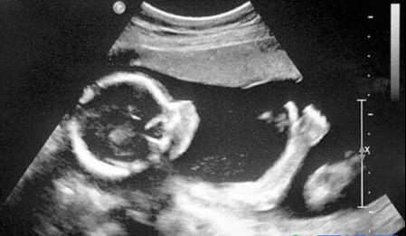 怀孕你不知道的十件事,几个怀孕小技巧看完绝对惊呆你