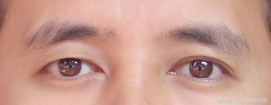 痣长在眼睛旁边是什么意思,眼睛旁边的痣能不能去掉