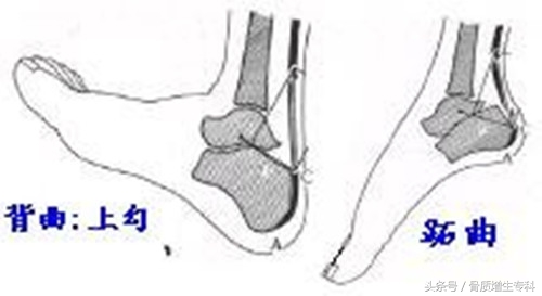 腰椎曲度变直并骨质增生怎么锻炼,颈椎间盘突出加骨质增生锻炼方法