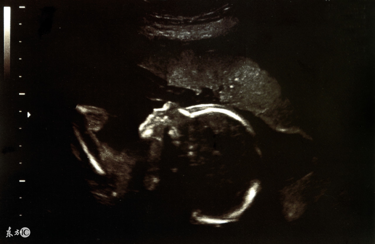 刚怀孕时有什么反应,刚怀孕有什么反应