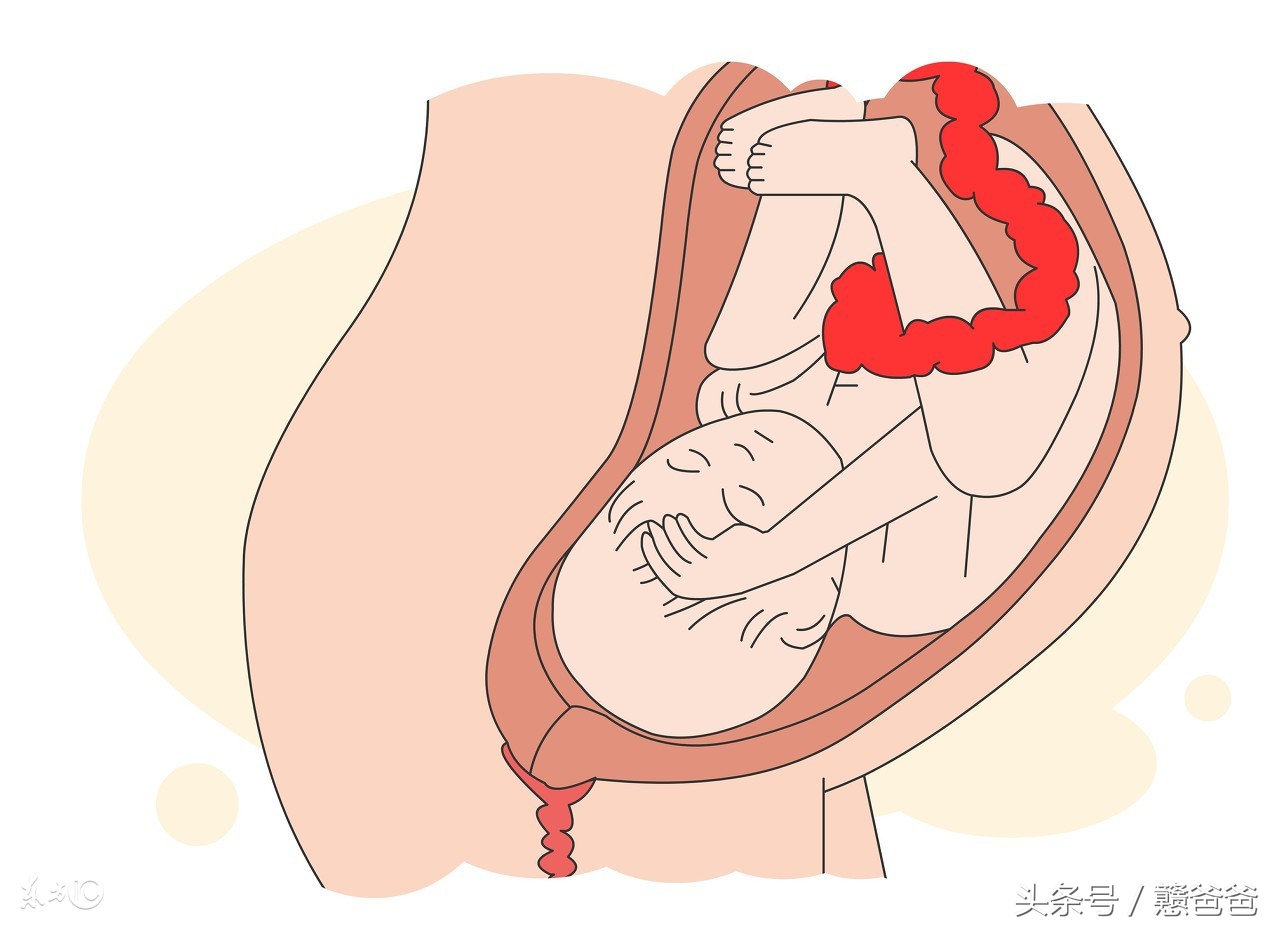 怀孕34周出现宫缩有早产迹象,孕35周宫缩频繁住院又没事了