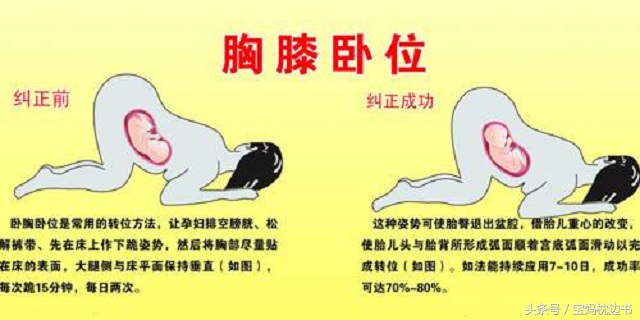 分娩期孩子头朝下,分娩头先出来还是脚先出来