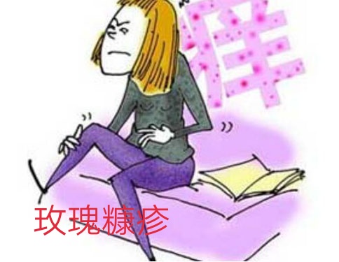 玫瑰糠疹有什么需要注意的,玫瑰糠疹自愈后还需要忌口吗