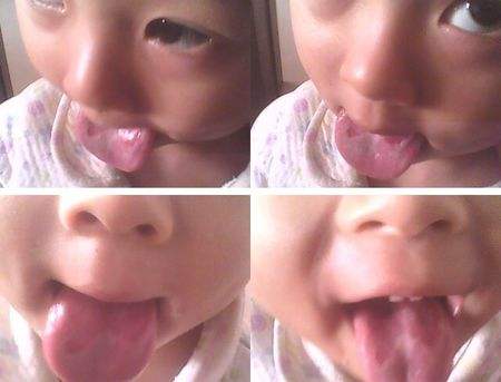 宝宝缺锌吃什么食物可以补锌,宝宝缺锌怎么补充多种维生素