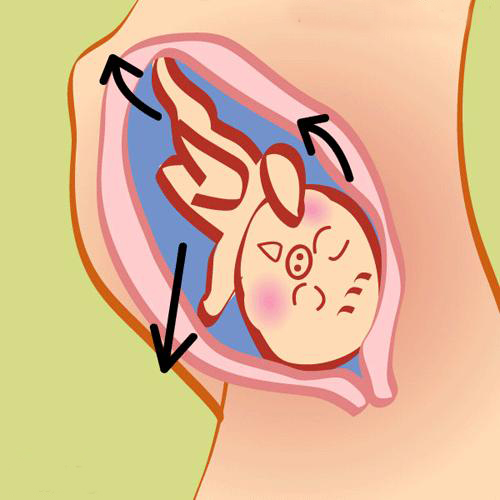 胎儿突然不怎么爱动是什么原因呢,胎儿突然不怎么动肚子发硬