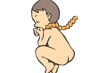 这些情况容易引起胎儿脐带绕颈窒息，孕妈们要注意了！