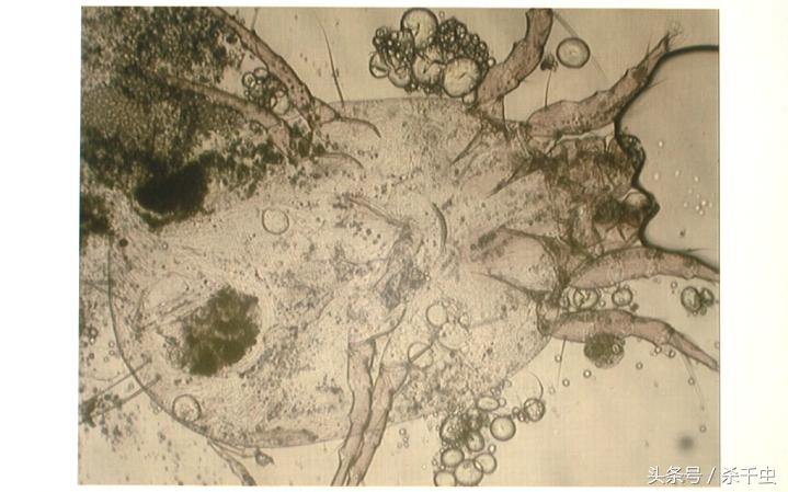 只要放在床上就能去螨虫的东西,螨虫克星帮你赶掉螨虫