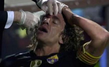 狮王之心普约尔,狮王普约尔