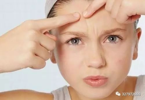 朵嘉浓晓晓:闭合粉刺的成因和预防