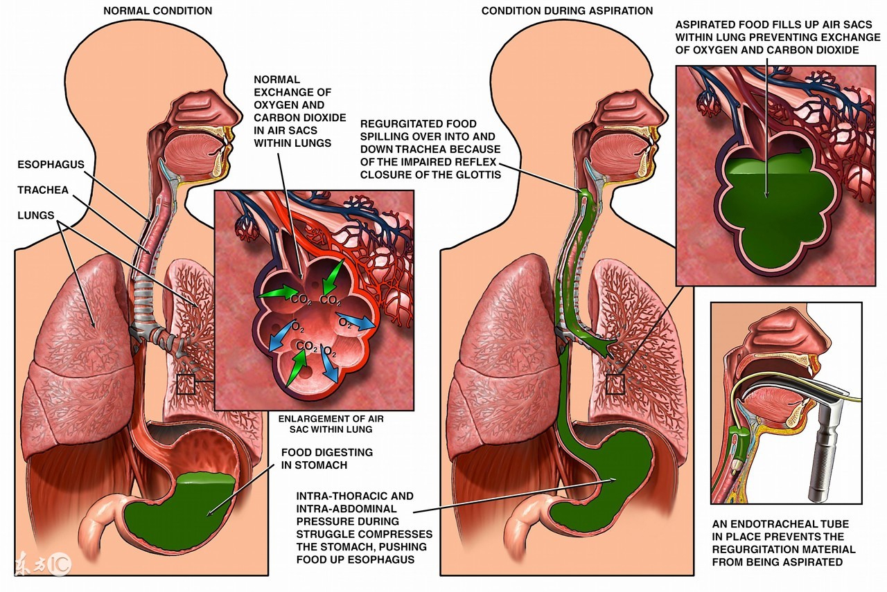 女人吃皮蛋有什么好处与坏处,皮蛋对肺结节肝囊肿有坏处吗