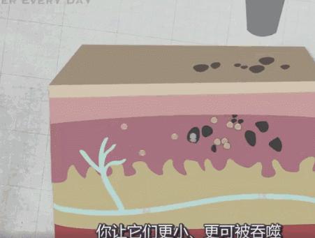 激光洗纹身需要修复吗,纹身后悔了怎么办啊