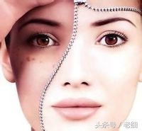 脸上有斑怎么调理呢，教你一个办法！