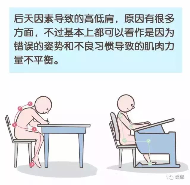 成年人驼背耸肩,一招拯救圆肩驼背