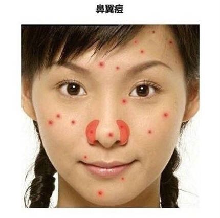 「看图识别长痘原因」还在苦恼长痘，如何祛痘，点开此文绝不后悔