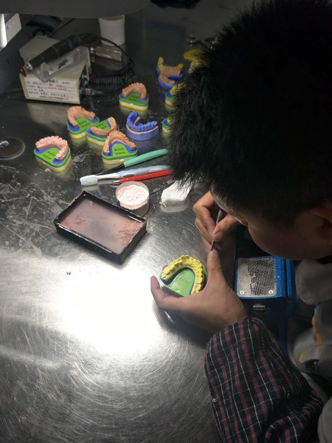 烤瓷牙连桥修复大概多少钱一颗,用烤瓷牙的方法矫正牙齿