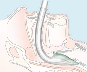 小伙心脏骤停路人使用aed抢救,男子心脏骤停急救医生当场崩溃