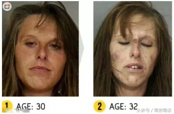 触目惊心吸毒前后真实的变化,吸毒的危害到底有多严重图片