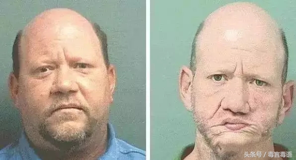 触目惊心吸毒前后真实的变化,吸毒的危害到底有多严重图片