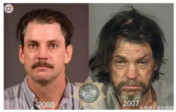 触目惊心吸毒前后真实的变化,吸毒的危害到底有多严重图片