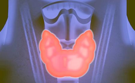 甲状腺热结节和凉结节的区别,甲状腺结节手术和甲亢手术一样吗