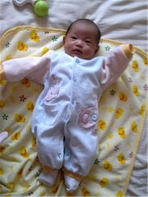 新生儿脚内翻怎么判断严重,新生儿脚内翻有什么方法矫正