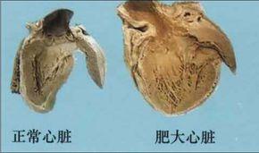 红牛功能性饮料和风味饮料区别,喝红牛功能饮料真的有什么功能吗