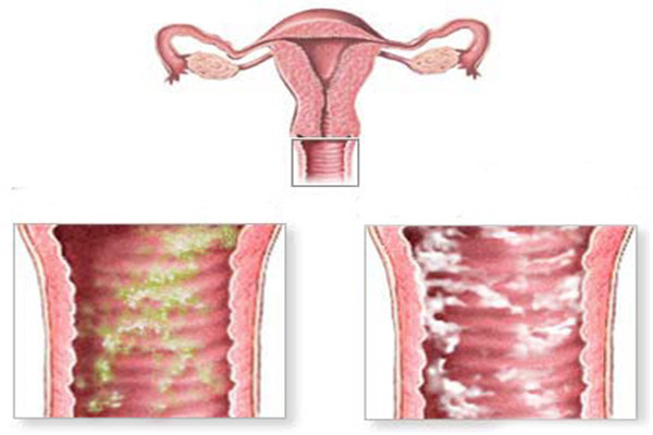 春玲医生上皮细胞肿瘤严重吗,春玲治什么病