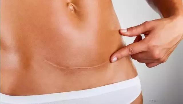 超过这个年纪必须剖宫产？！这究竟有科学依据吗？