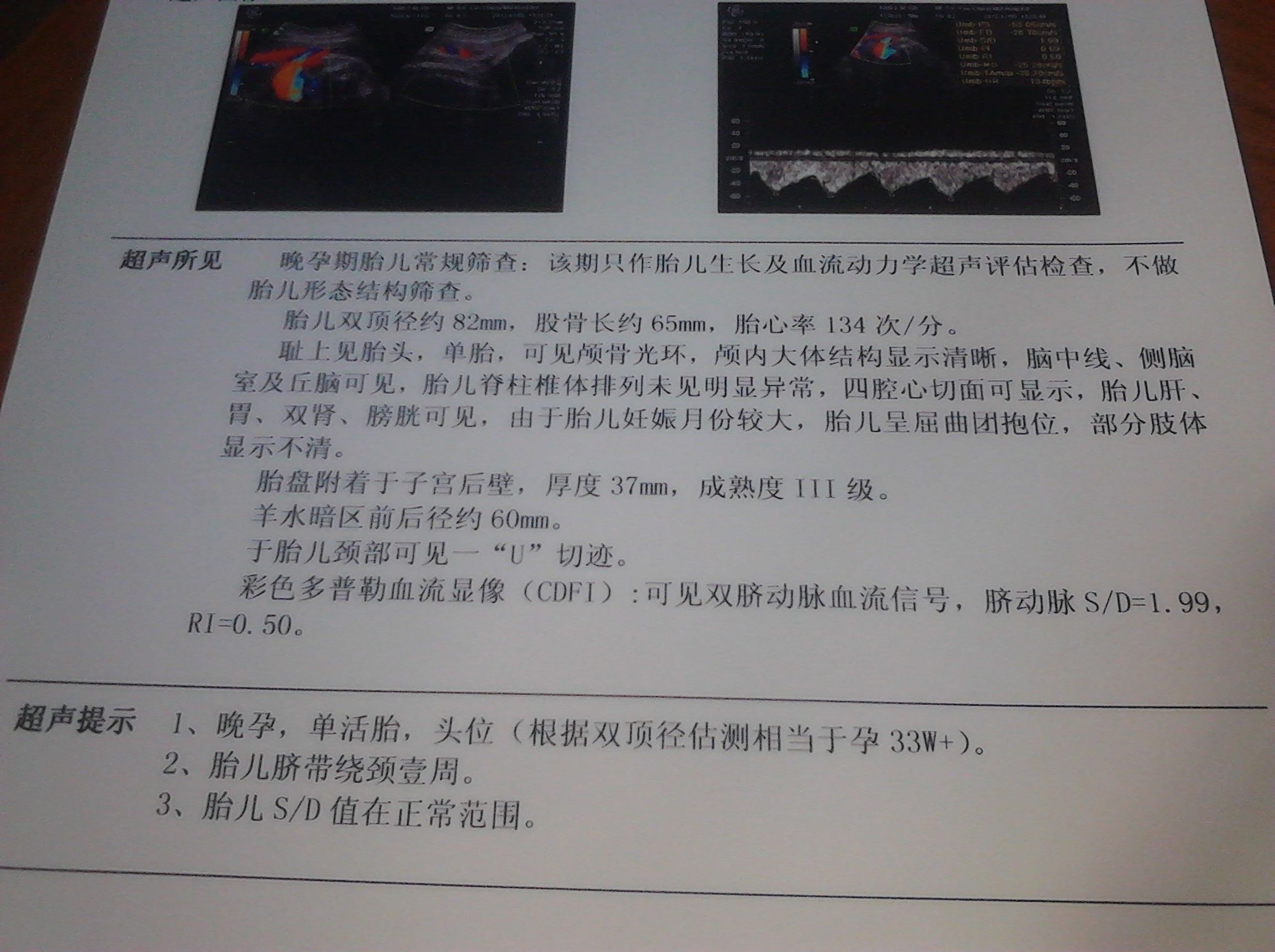 b超检查妈妈可以看屏幕吗,教你看b超单免去不必要的担心