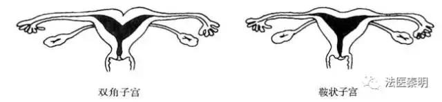 三胞胎的子宫变化,他们是三胞胎姐妹