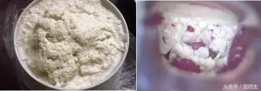 舌尖上的医疗,舌尖上的医疗篇