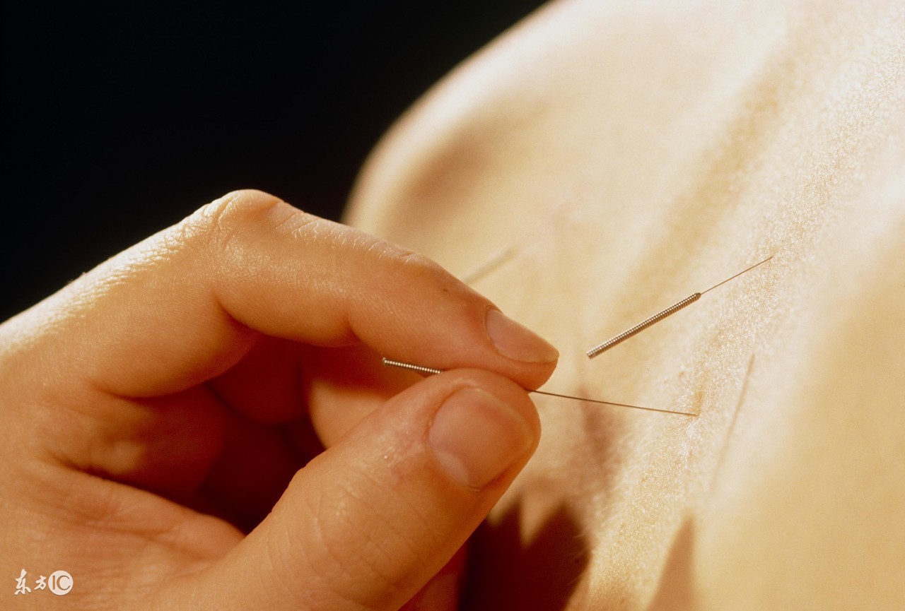 中医“萌新”的福利！针灸心得整理！