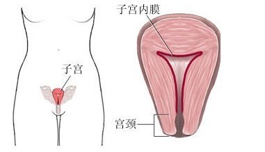 子宫内膜异位症和子宫腺肌症,子宫内膜异位症有哪些不能吃