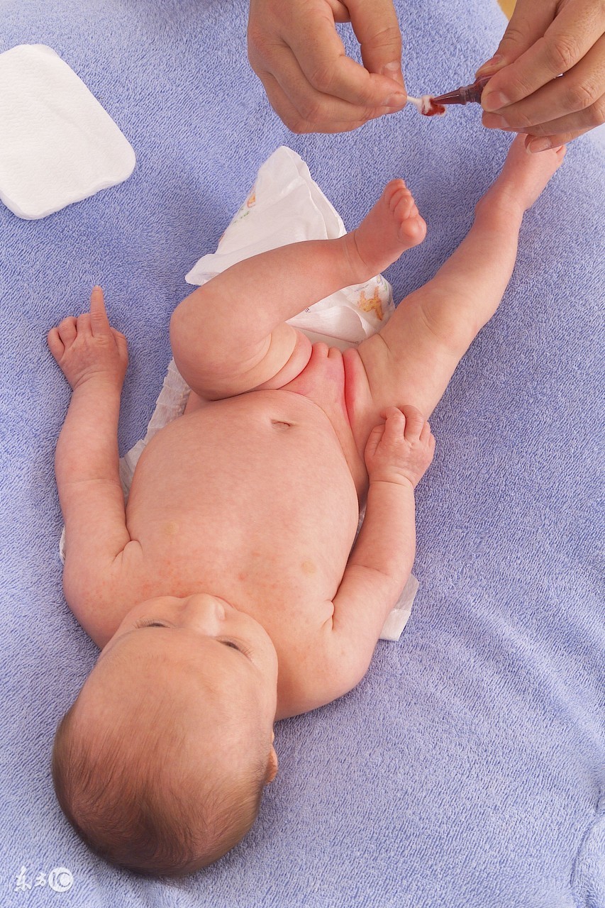 应对尿布疹，这些神器该备着，收好不谢