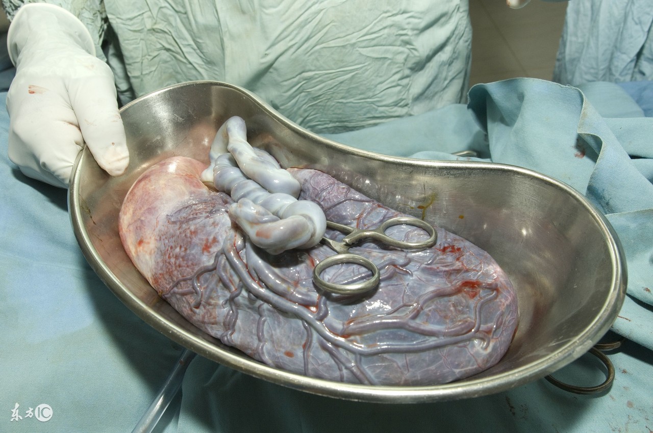 胎盘如何处置对宝宝好,胎盘怎么处置对孩子大人好