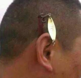 钓鱼怎么防止被钩到手,怎么钓鱼才不会被钩到呢