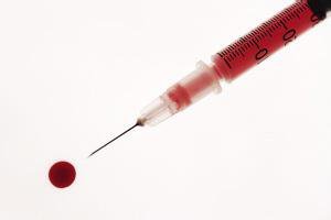 体检报告中总胆红素高怎么回事,体检总胆汁酸高什么原因