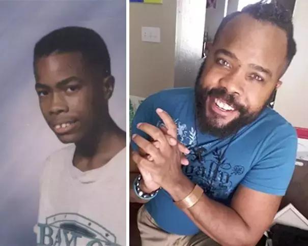 后悔整牙和不后悔整牙,整牙一般整到什么样就可以了