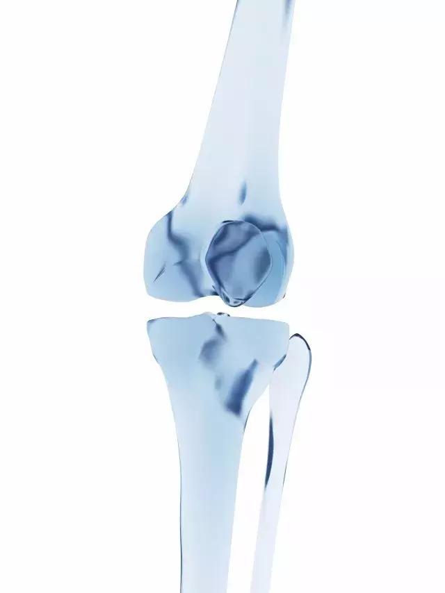 骨折后至少应该做好这3件事,髌骨骨折后二次手术几月做好