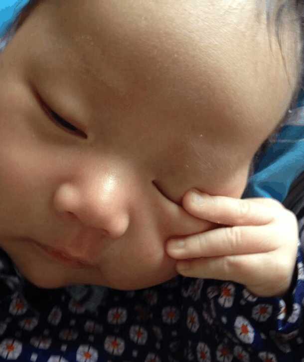 3个月的小宝宝容易长湿疹,刚出生宝宝一脸湿疹