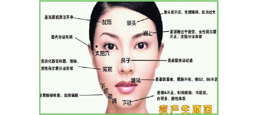 面部痘痘认知,痘痘的认知