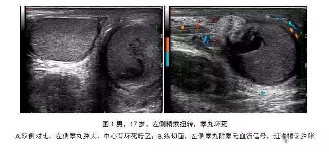 太原男性睾丸保养调理,太原男性前列腺炎该怎么治疗