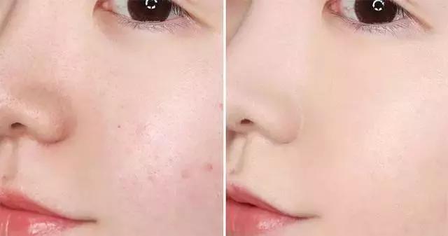 十大最好干皮遮瑕粉底液,秋冬季节适合用的粉底最新