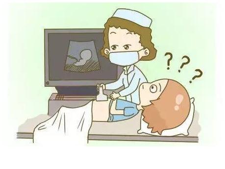 做四维的时候宝宝居然笑了,四维一遍过宝宝是聪明还是不聪明