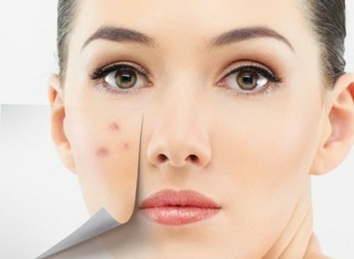 女性外面长了小痘,外面长什么痘里面就有什么病