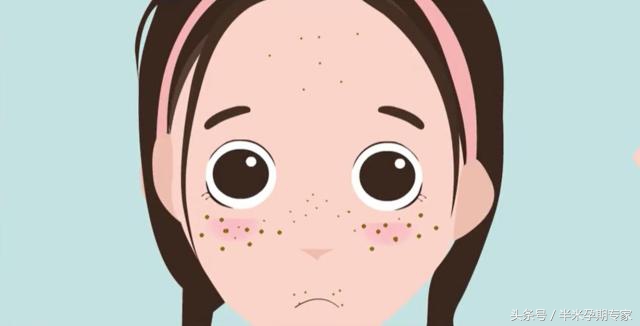 孕期色素沉着可以缓解吗,孕期色素沉淀多久恢复