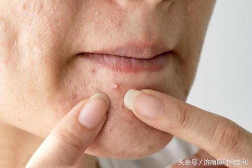 三甲医院通用的《疾病先兆自查表》，我用了几十年，现在还在用！