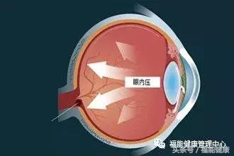 用电脑体检,电脑测眼压