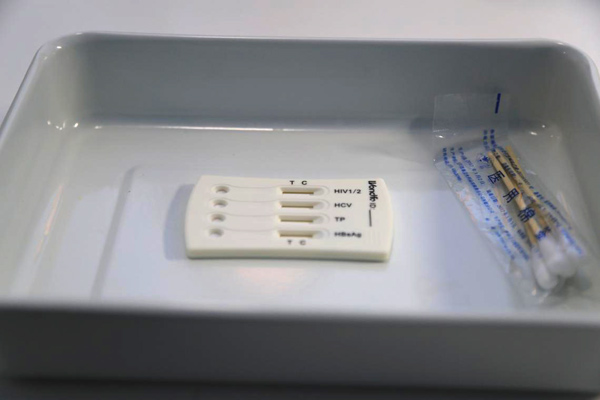 检测试纸艾滋病,检测艾滋病的试纸价格