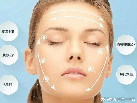 线雕的优势,线雕的效果